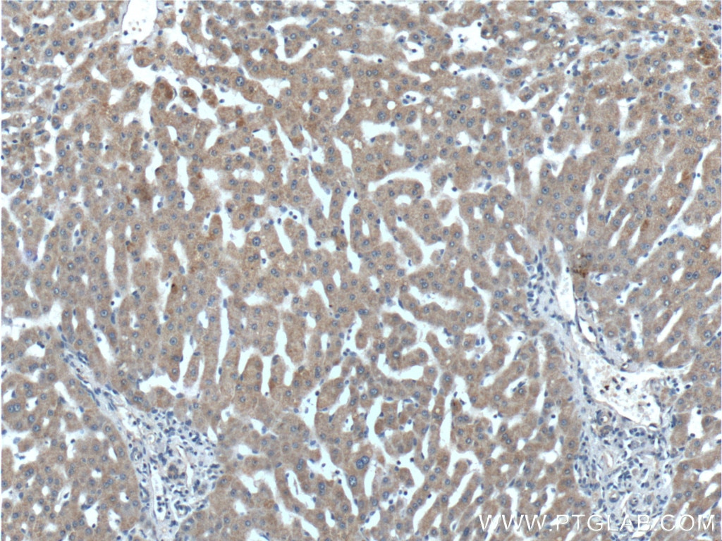 Immunohistochemistry (IHC) staining of human liver tissue using IGFBP4 Polyclonal antibody (18500-1-AP)