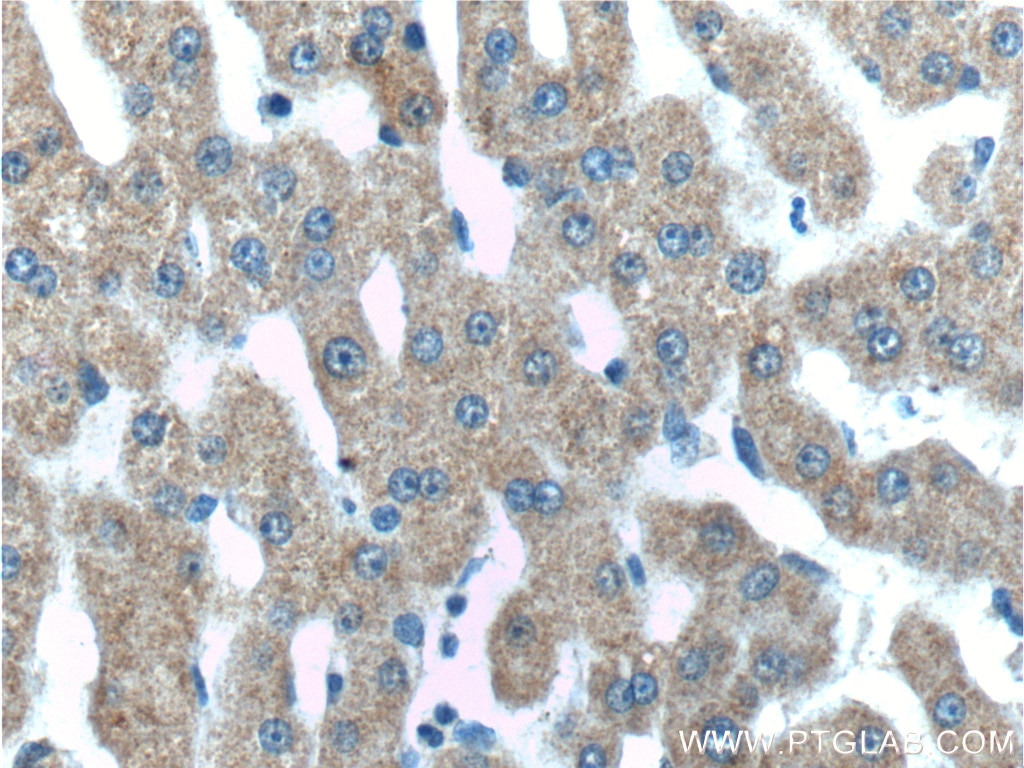 Immunohistochemistry (IHC) staining of human liver tissue using IGFBP4 Polyclonal antibody (18500-1-AP)