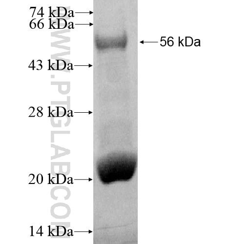IGFBP4 fusion protein Ag13347 SDS-PAGE