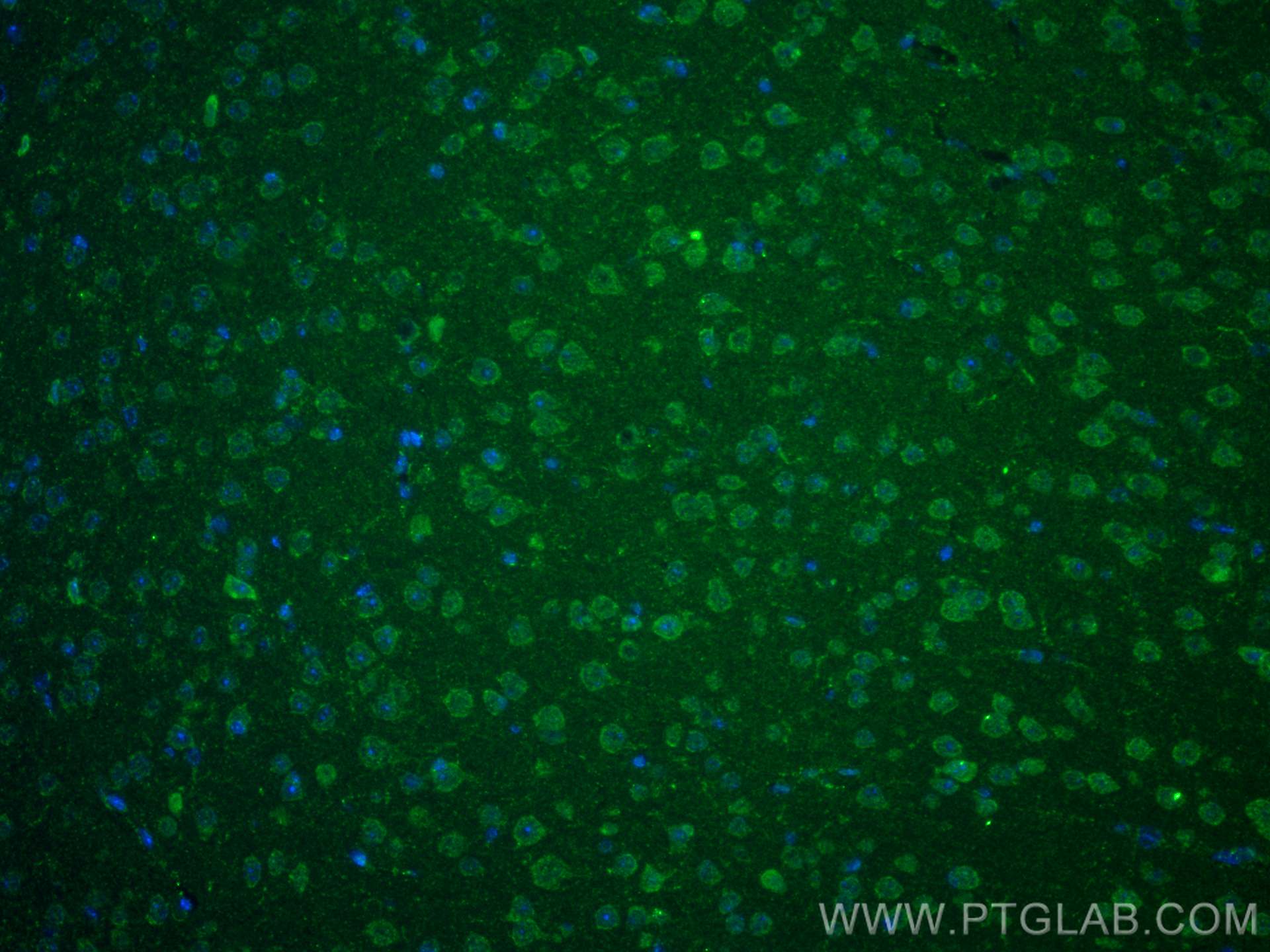 Immunofluorescence (IF) / fluorescent staining of mouse brain tissue using IGFBP5 Polyclonal antibody (55205-1-AP)