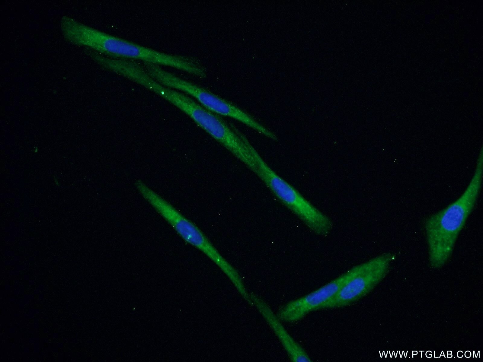Immunofluorescence (IF) / fluorescent staining of SKOV-3 cells using IGFBP5 Polyclonal antibody (55205-1-AP)