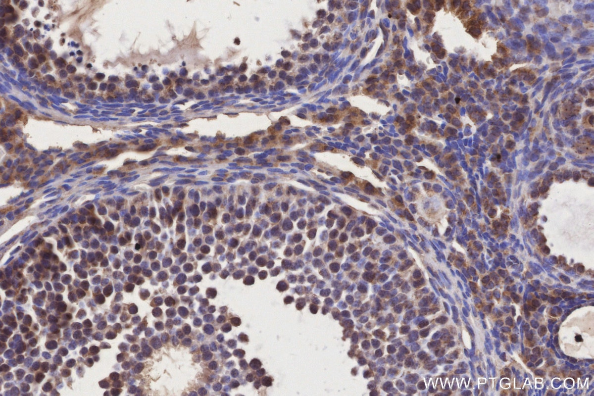 Immunohistochemistry (IHC) staining of mouse ovary tissue using IGFBP5 Polyclonal antibody (55205-1-AP)