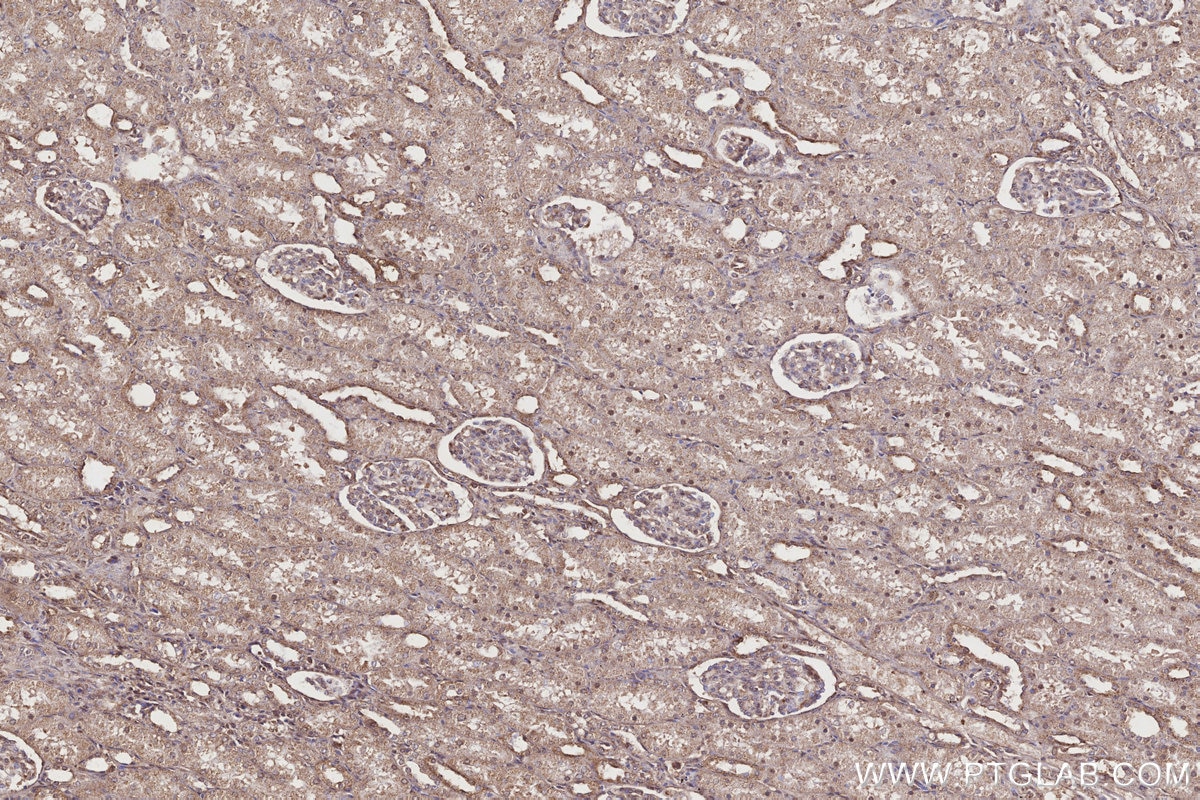 Immunohistochemistry (IHC) staining of human kidney tissue using IGFBP5 Polyclonal antibody (55205-1-AP)