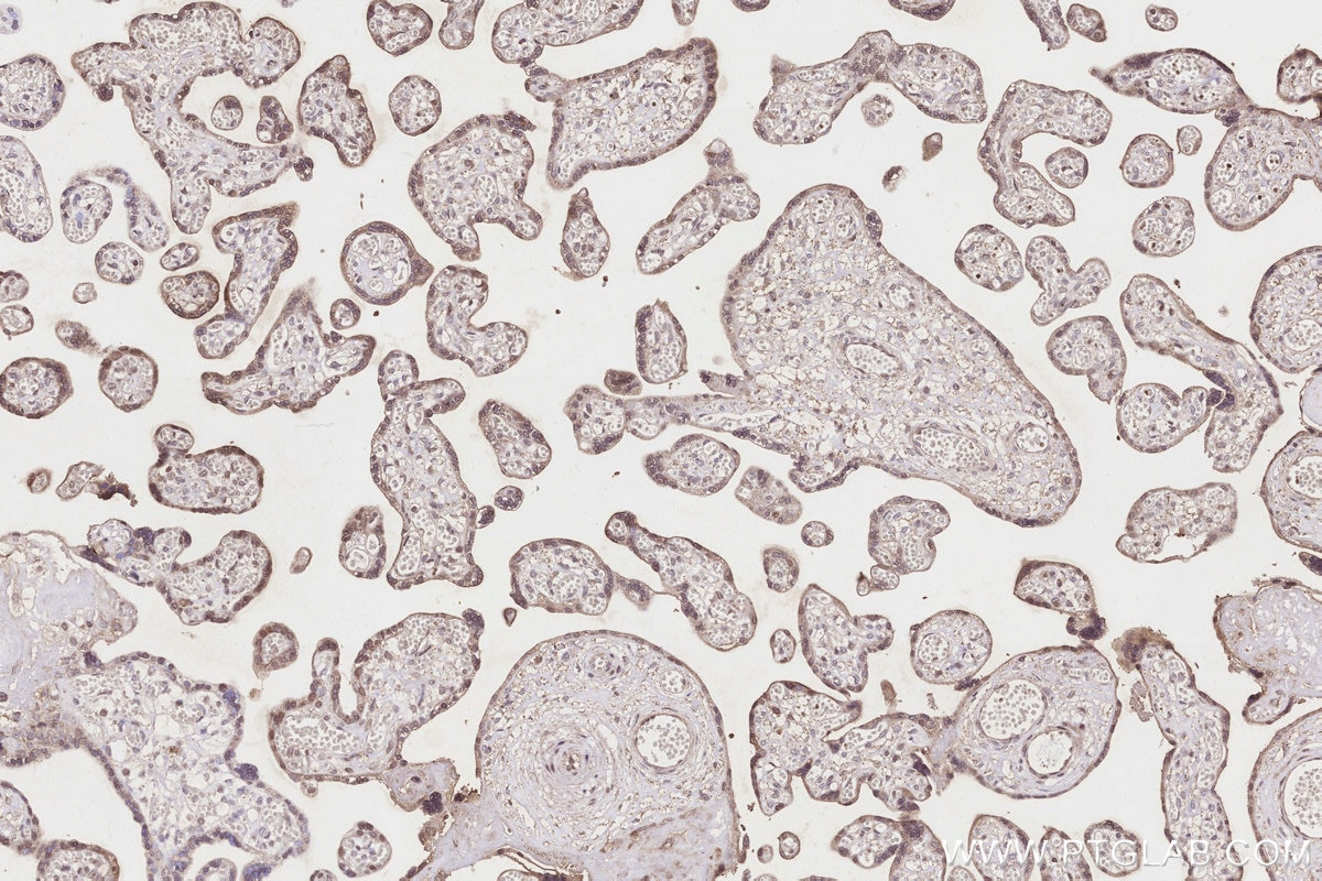 Immunohistochemistry (IHC) staining of human placenta tissue using IGFBP5 Polyclonal antibody (55205-1-AP)