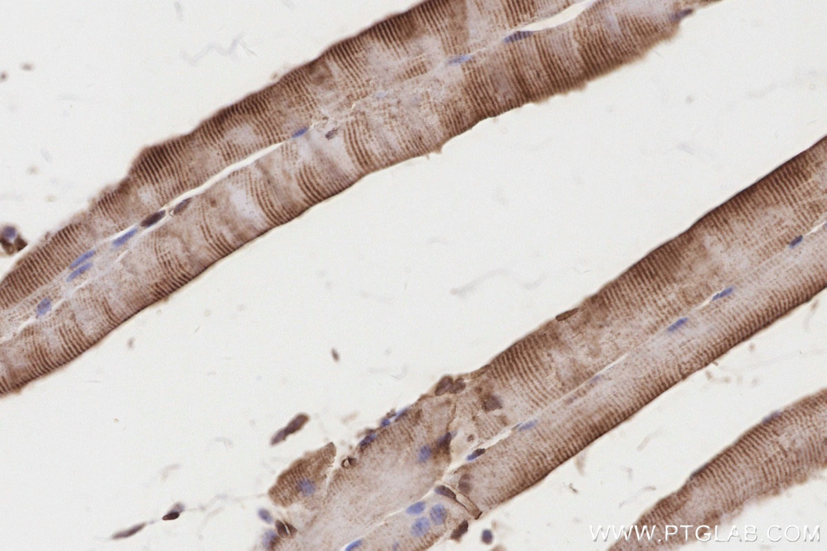 Immunohistochemistry (IHC) staining of mouse skeletal muscle tissue using IGFBP5 Polyclonal antibody (55205-1-AP)