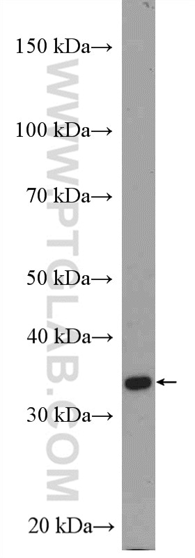 Western Blot (WB) analysis of SKOV-3 cells using IGFBP5 Polyclonal antibody (55205-1-AP)