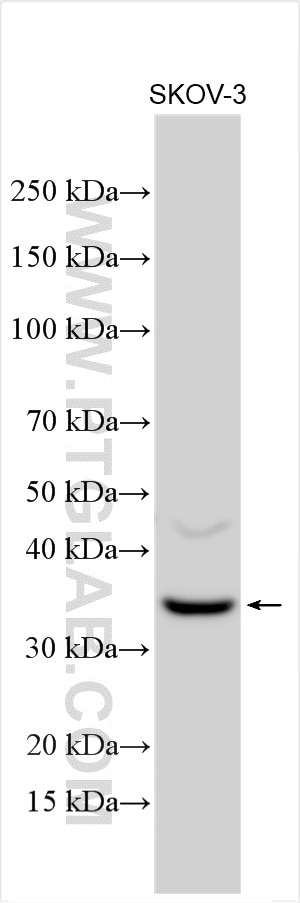 Western Blot (WB) analysis of various lysates using IGFBP5 Polyclonal antibody (55205-1-AP)