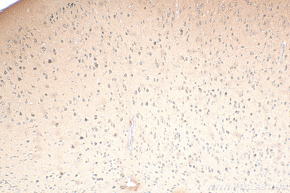 Immunohistochemistry (IHC) staining of mouse brain tissue using IGFBP5 Monoclonal antibody (68512-1-Ig)