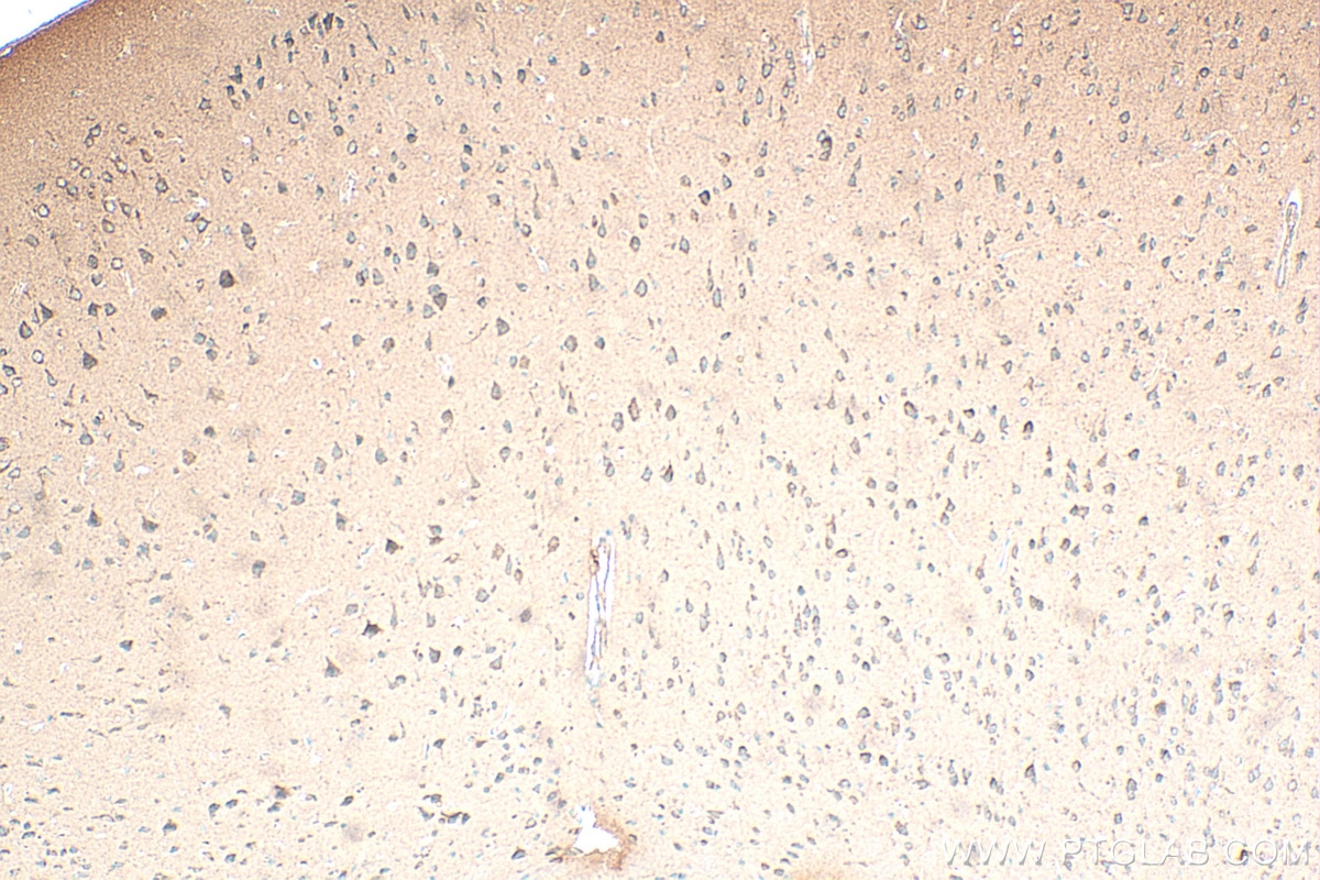Immunohistochemistry (IHC) staining of mouse brain tissue using IGFBP5 Monoclonal antibody (68512-1-Ig)