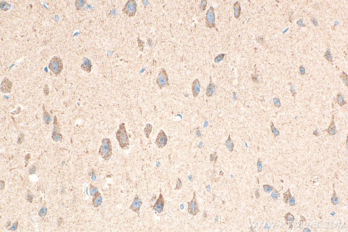 Immunohistochemistry (IHC) staining of mouse brain tissue using IGFBP5 Monoclonal antibody (68512-1-Ig)