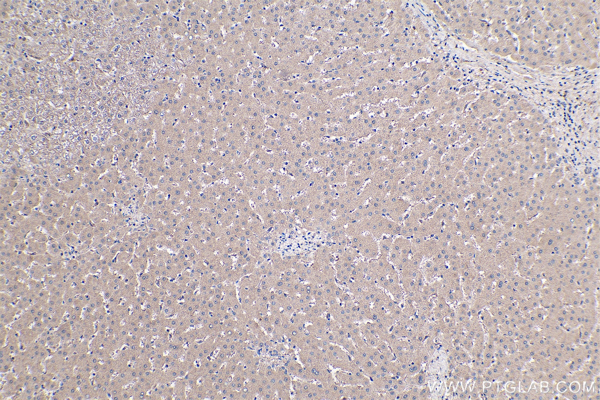 Immunohistochemistry (IHC) staining of human liver tissue using IGFBP6 Monoclonal antibody (67567-1-Ig)