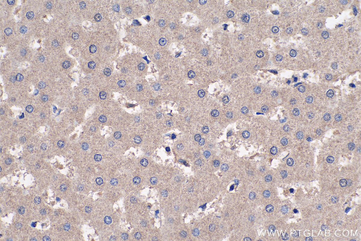 Immunohistochemistry (IHC) staining of human liver tissue using IGFBP6 Monoclonal antibody (67567-1-Ig)