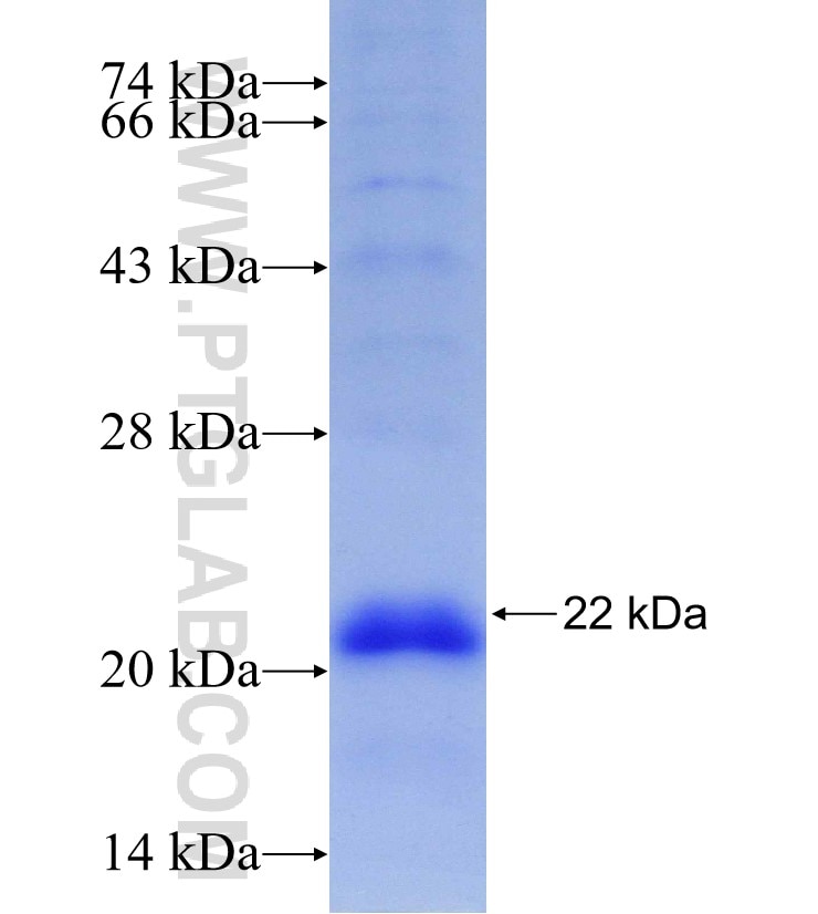 IGFBP6 fusion protein Ag30050 SDS-PAGE