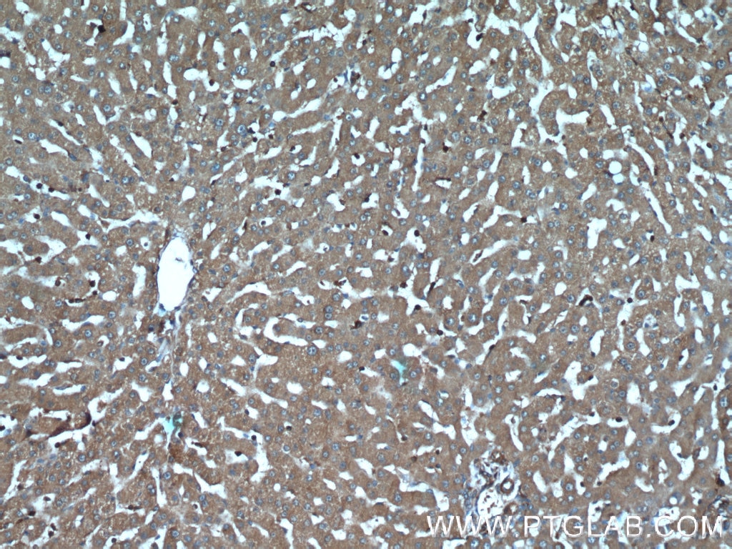 Immunohistochemistry (IHC) staining of human liver tissue using IGFBP7 Polyclonal antibody (19961-1-AP)