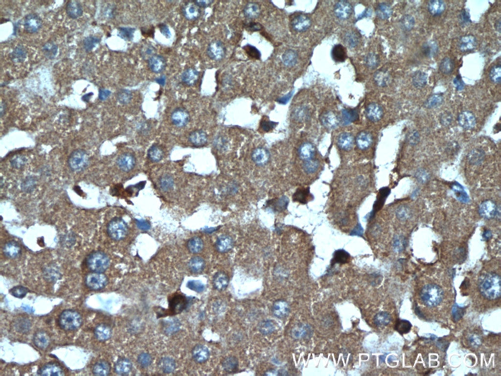 Immunohistochemistry (IHC) staining of human liver tissue using IGFBP7 Polyclonal antibody (19961-1-AP)