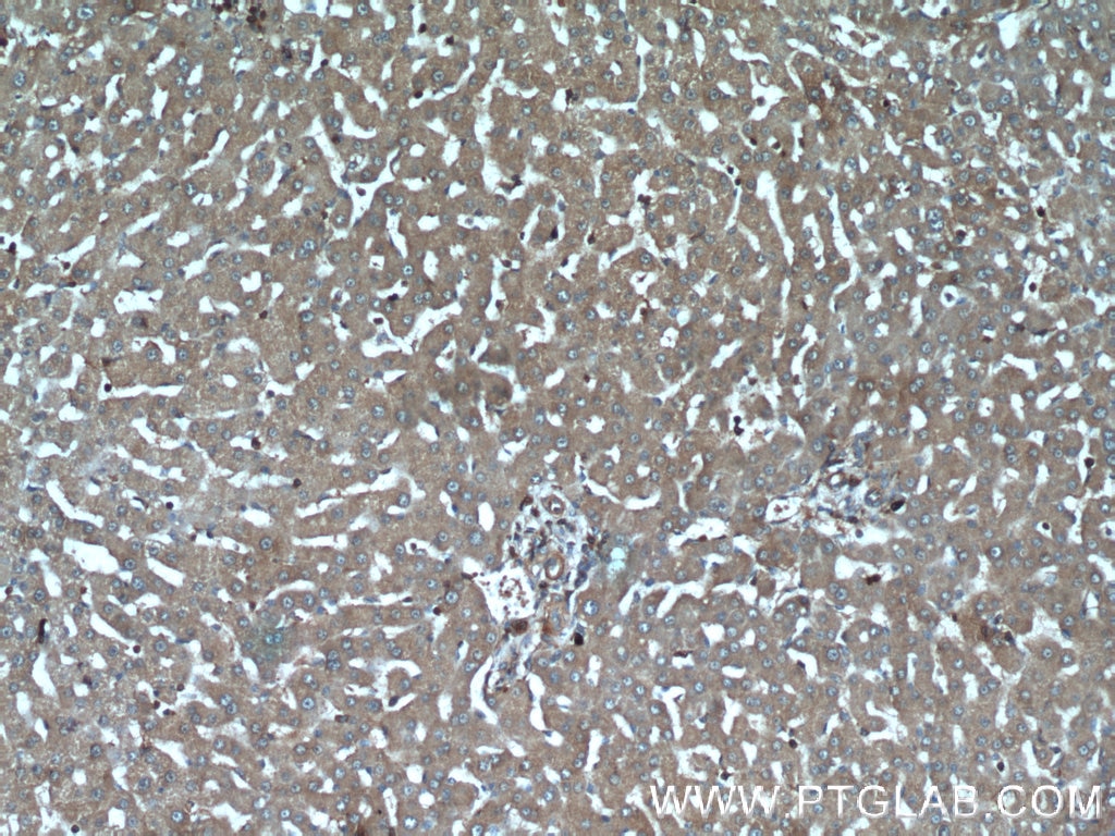 Immunohistochemistry (IHC) staining of human liver tissue using IGFBP7 Polyclonal antibody (19961-1-AP)