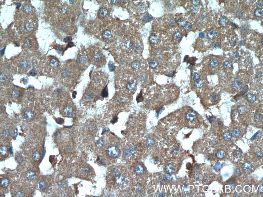 Immunohistochemistry (IHC) staining of human liver tissue using IGFBP7 Polyclonal antibody (19961-1-AP)
