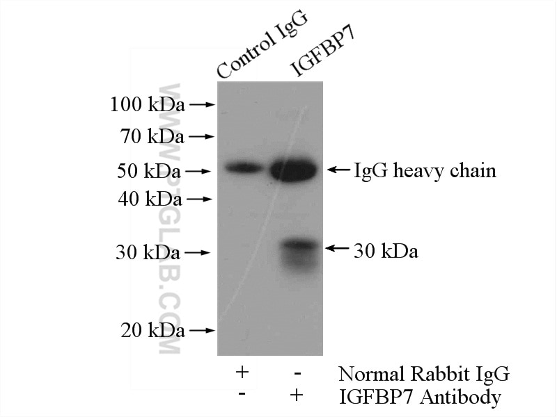 Immunoprecipitation (IP) experiment of mouse appendix tissue using IGFBP7 Polyclonal antibody (19961-1-AP)