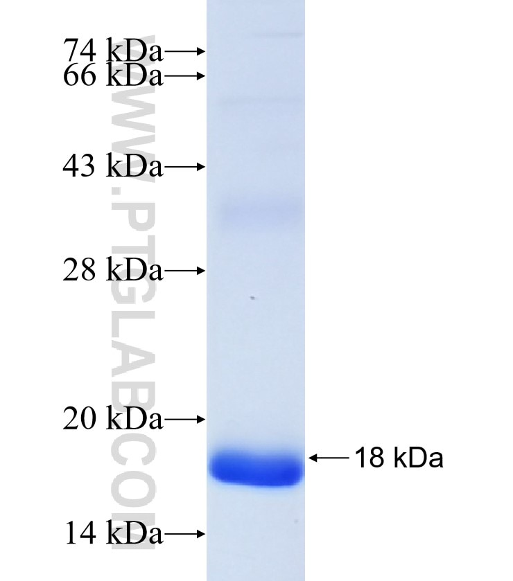 IGFBP7 fusion protein Ag33208 SDS-PAGE IGFBP7 fusion protein Ag33208 SDS-PAGE