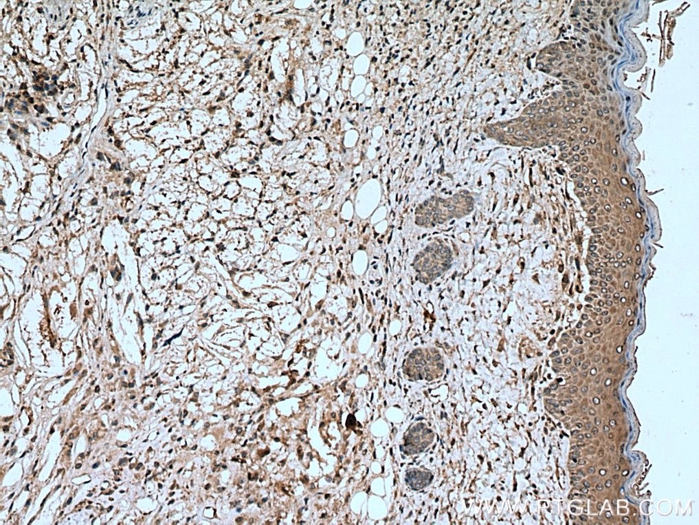 IHC staining of mouse skin using 20545-1-AP