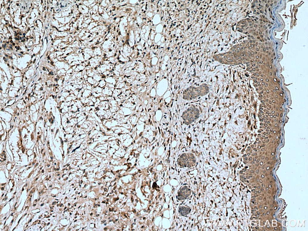 Immunohistochemistry (IHC) staining of mouse skin tissue using IGFL1 Polyclonal antibody (20545-1-AP)