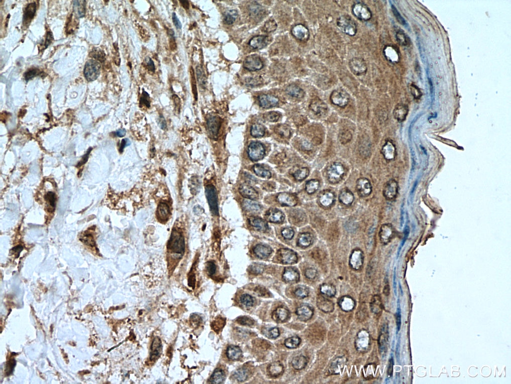 Immunohistochemistry (IHC) staining of mouse skin tissue using IGFL1 Polyclonal antibody (20545-1-AP)
