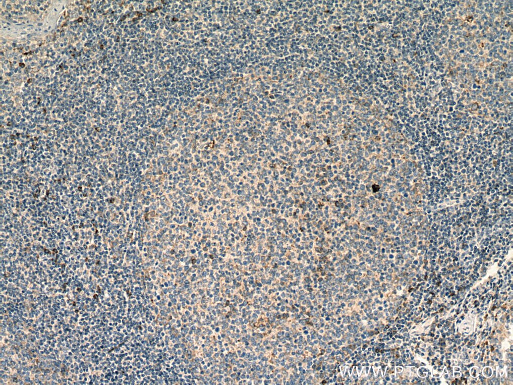 Immunohistochemistry (IHC) staining of human tonsillitis tissue using IGFL1 Polyclonal antibody (20545-1-AP)