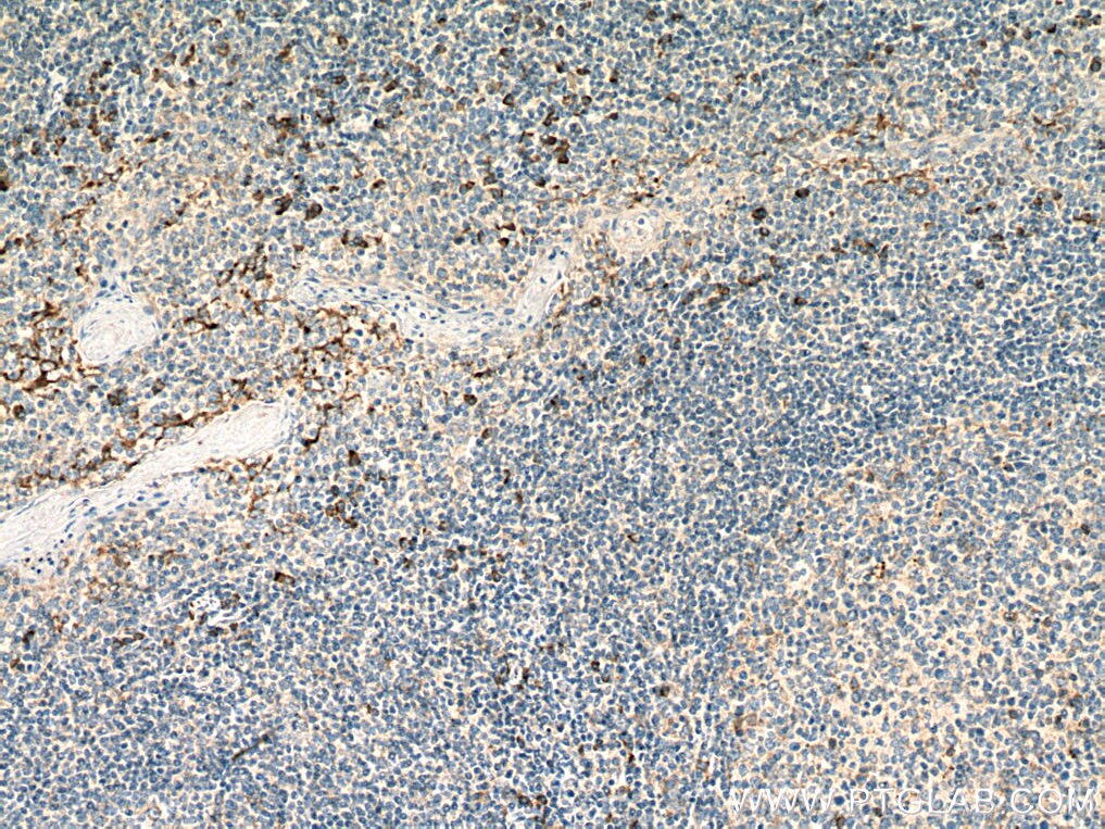 Immunohistochemistry (IHC) staining of human tonsillitis tissue using IGFL1 Polyclonal antibody (20545-1-AP)