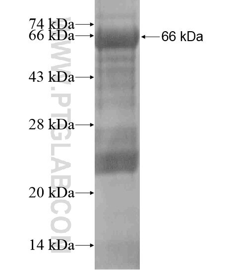 IGFN1 fusion protein Ag18731 SDS-PAGE