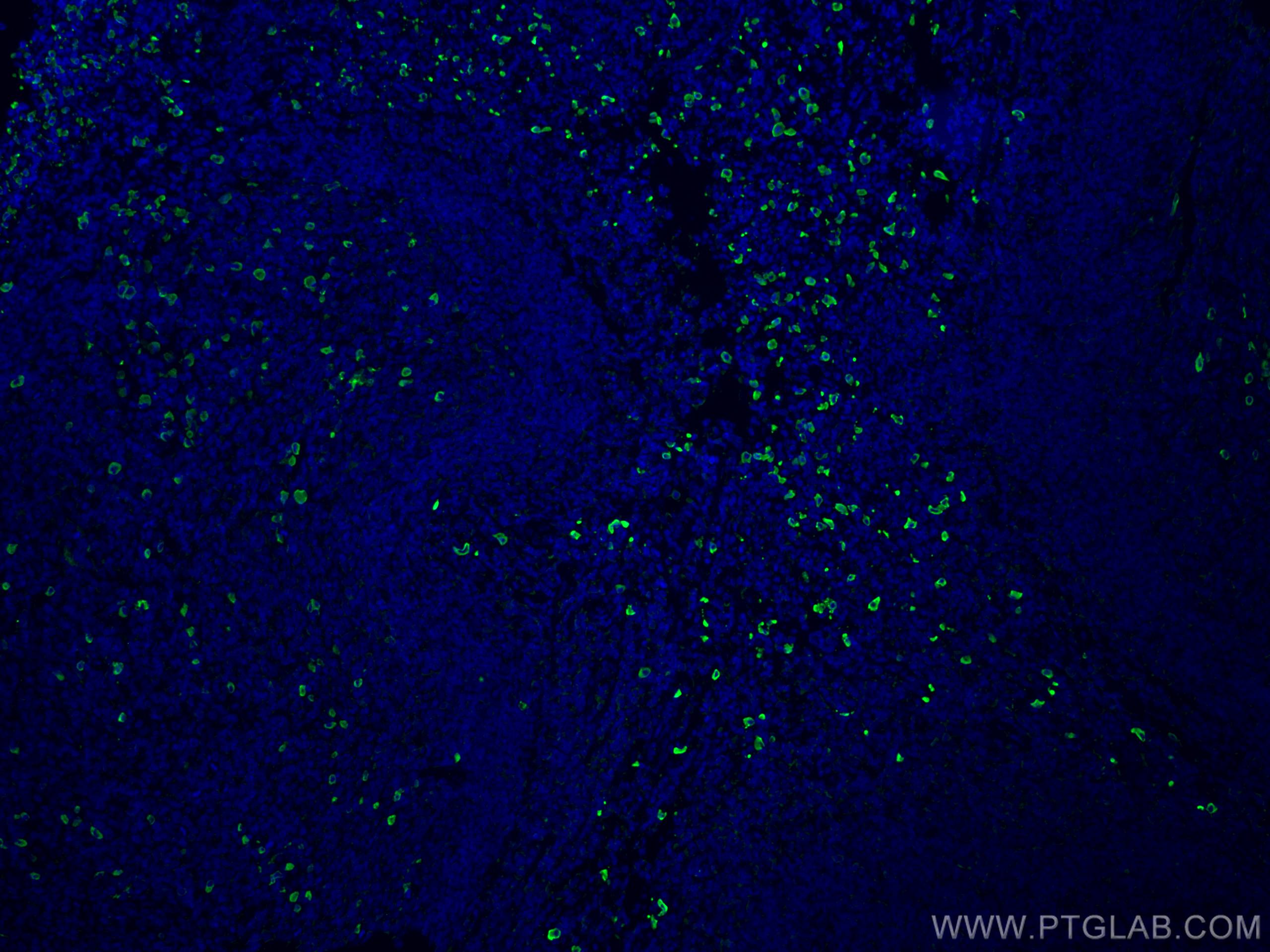 Immunofluorescence (IF) / fluorescent staining of human tonsillitis tissue using Human IgA Heavy Chain Polyclonal antibody (11449-1-AP)