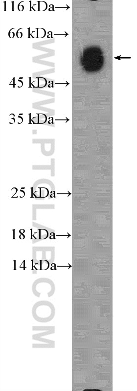 Western Blot (WB) analysis of human plasma using Human IgA Heavy Chain Polyclonal antibody (11449-1-AP)