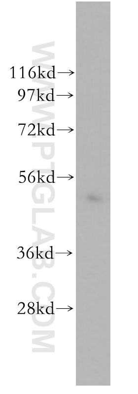 Western Blot (WB) analysis of human lung tissue using Human IgA Heavy Chain Polyclonal antibody (11449-1-AP)