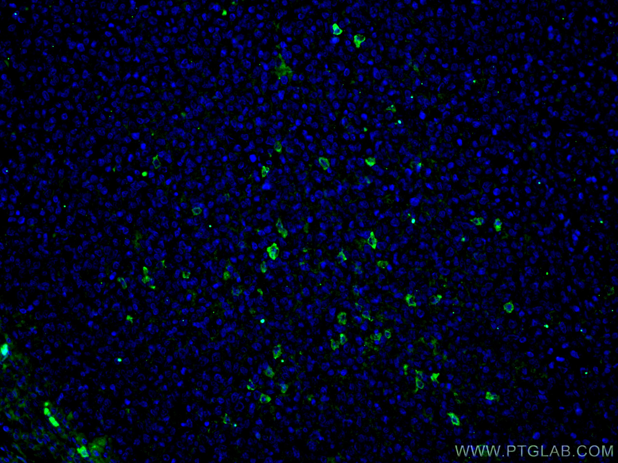 Immunofluorescence (IF) / fluorescent staining of human tonsillitis tissue using Human IgA Monoclonal antibody (60099-1-Ig)