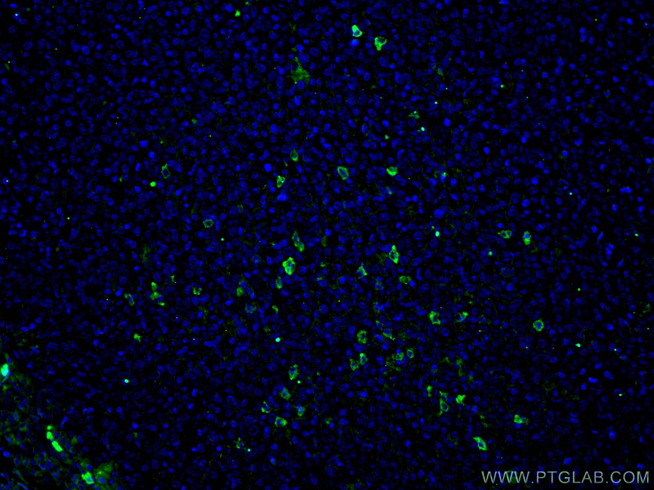 IF Staining of human tonsillitis using 60099-1-Ig