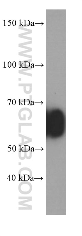 Western Blot (WB) analysis of human plasma using Human IgA Monoclonal antibody (60099-1-Ig)