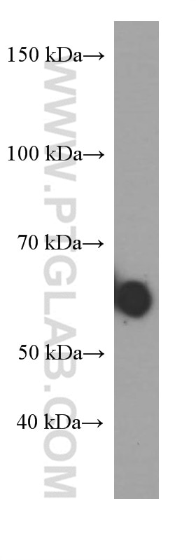 Western Blot (WB) analysis of human saliva using Human IgA Monoclonal antibody (60099-1-Ig)