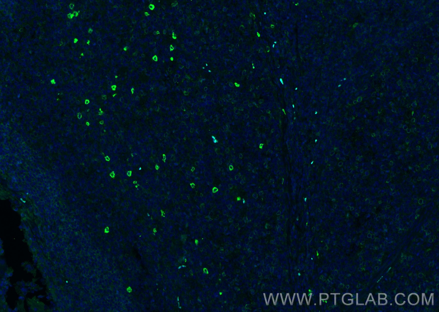 Immunofluorescence (IF) / fluorescent staining of human tonsillitis tissue using human IgD Polyclonal antibody (16489-1-AP)