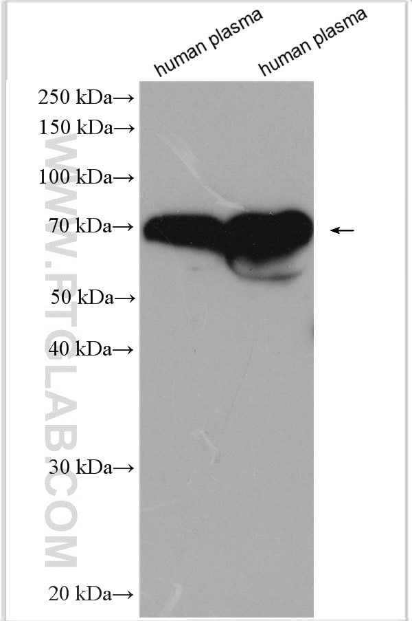 Western Blot (WB) analysis of various lysates using human IgD Polyclonal antibody (16489-1-AP)