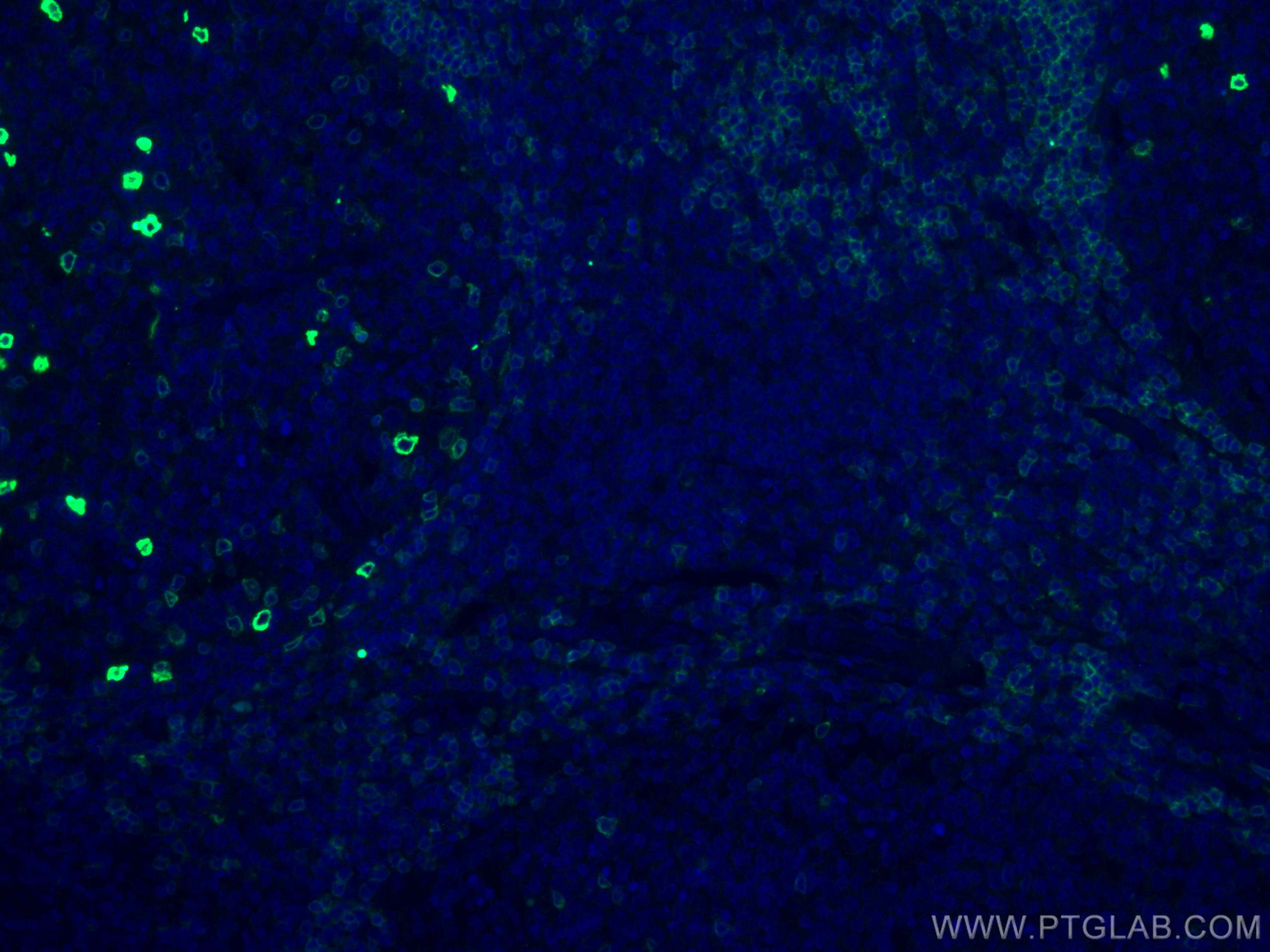 Immunofluorescence (IF) / fluorescent staining of human tonsillitis tissue using human IgD Monoclonal antibody (67538-1-Ig)