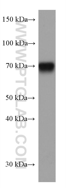 Western Blot (WB) analysis of human plasma using human IgD Monoclonal antibody (67538-1-Ig)