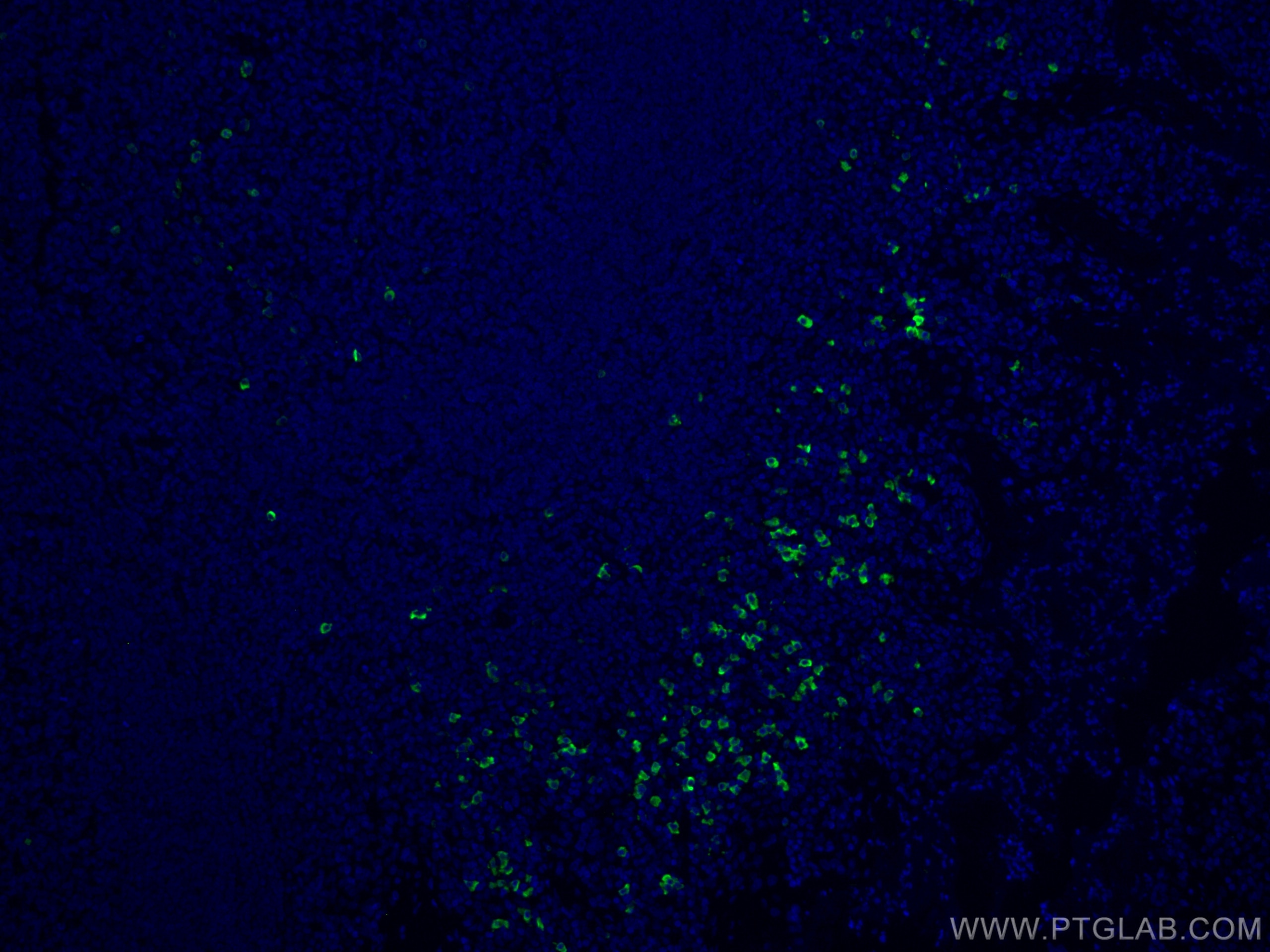 Immunofluorescence (IF) / fluorescent staining of human tonsillitis tissue using CoraLite® Plus 488-conjugated human IgD Polyclonal (CL488-16489)