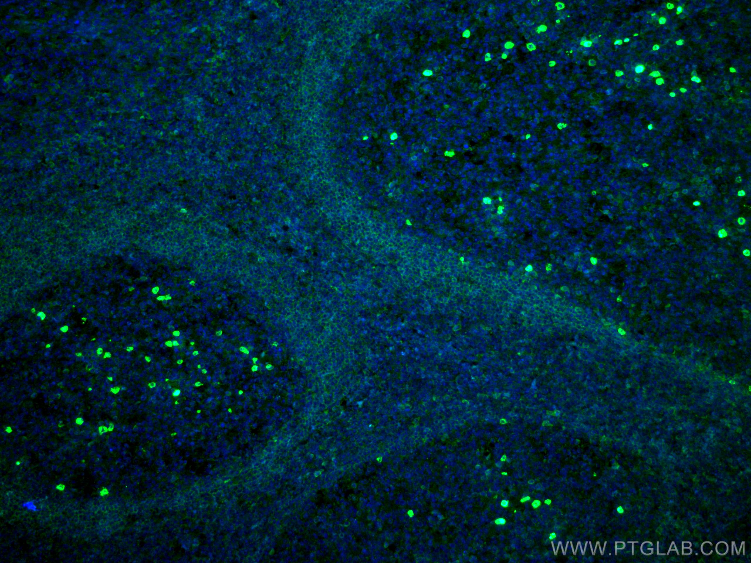 Immunofluorescence (IF) / fluorescent staining of human tonsillitis tissue using CoraLite® Plus 488-conjugated human IgD Monoclonal (CL488-67538)