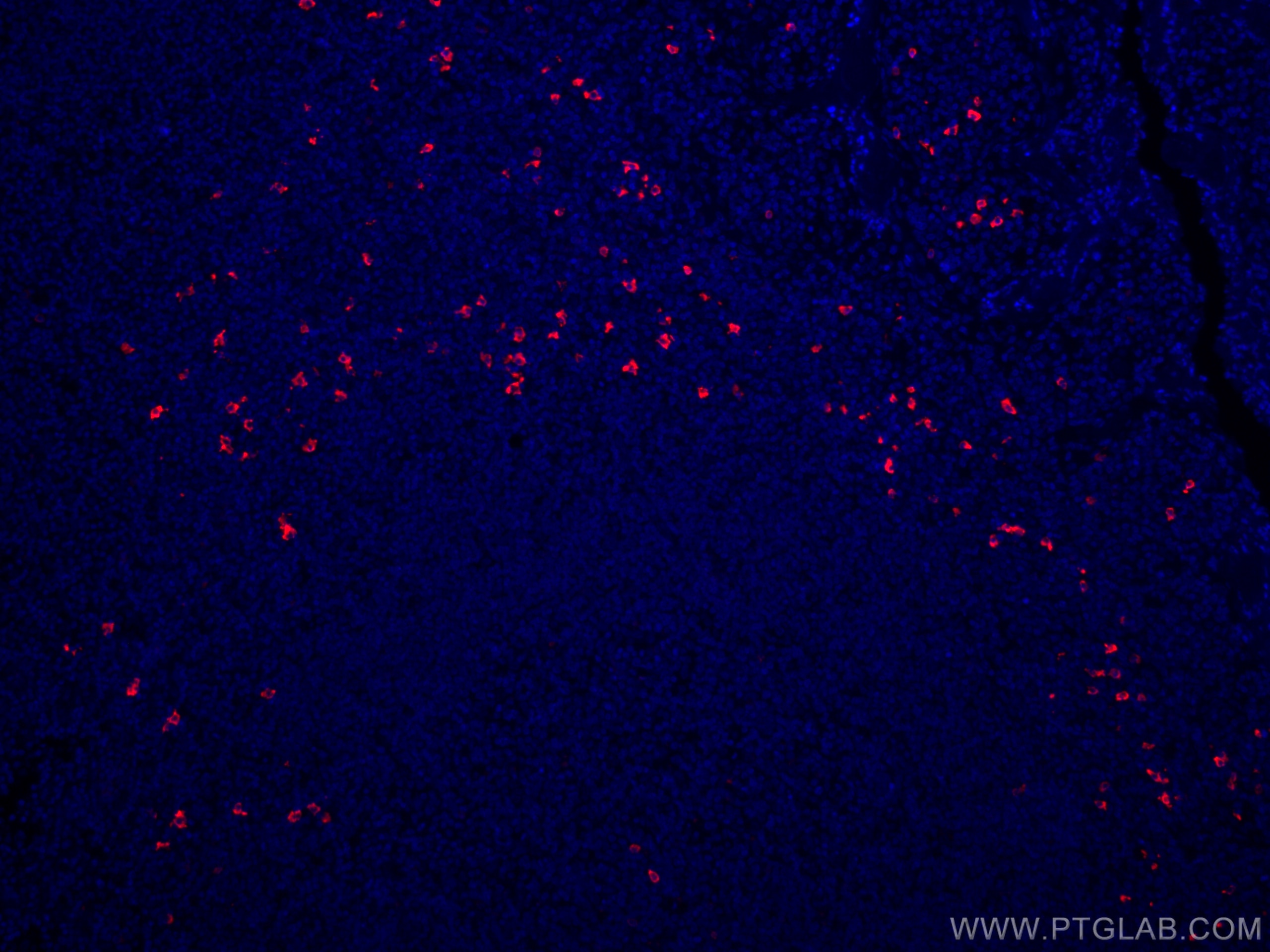 Immunofluorescence (IF) / fluorescent staining of human tonsillitis tissue using CoraLite®594-conjugated human IgD Polyclonal antib (CL594-16489)