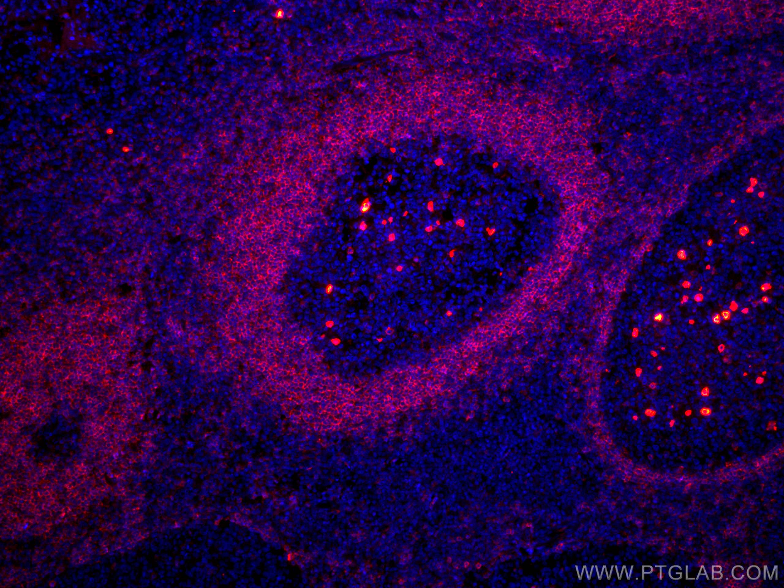 Immunofluorescence (IF) / fluorescent staining of human tonsillitis tissue using CoraLite®594-conjugated human IgD Monoclonal antib (CL594-67538)