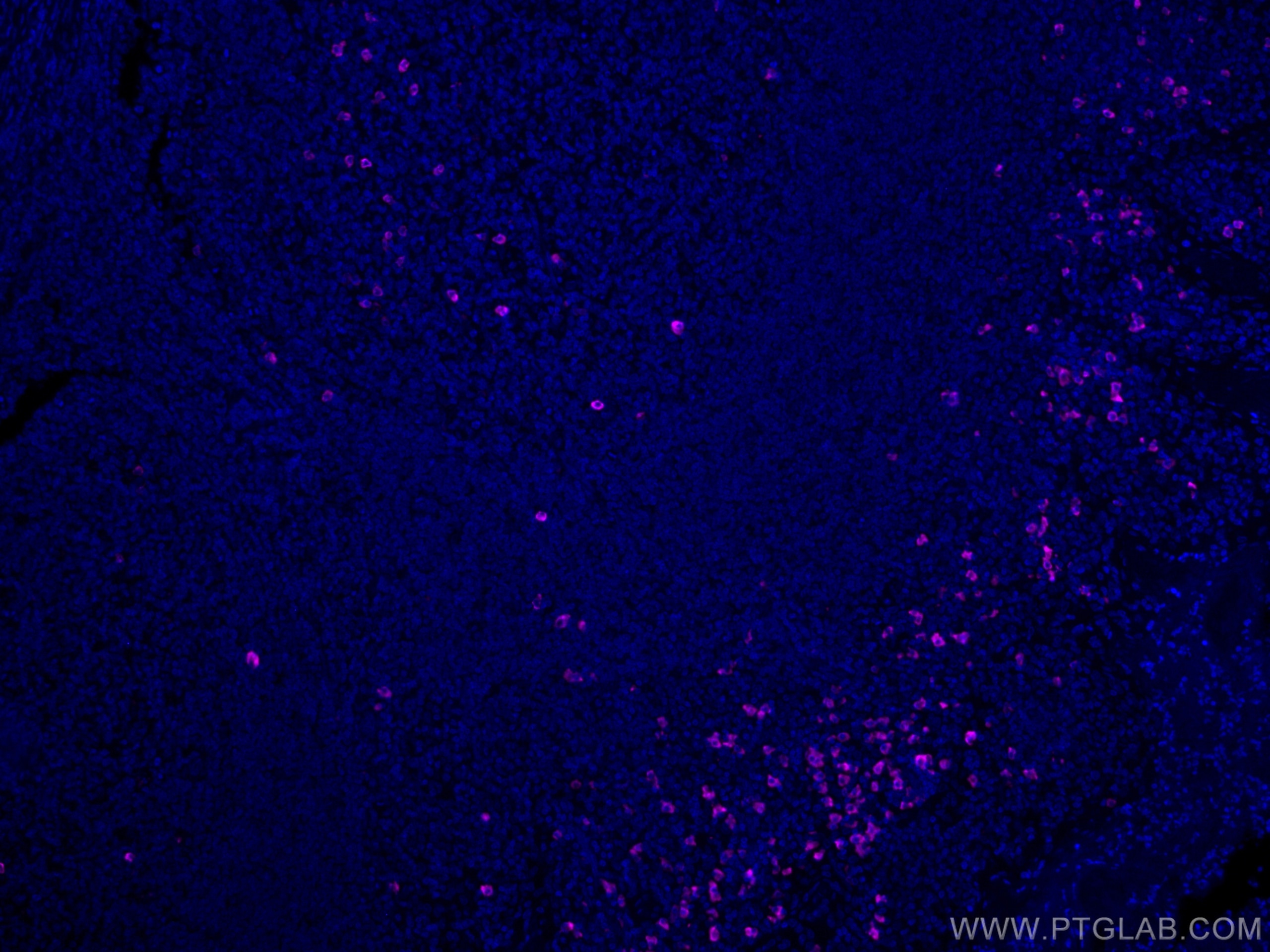 Immunofluorescence (IF) / fluorescent staining of human tonsillitis tissue using CoraLite® Plus 647-conjugated human IgD Polyclonal (CL647-16489)