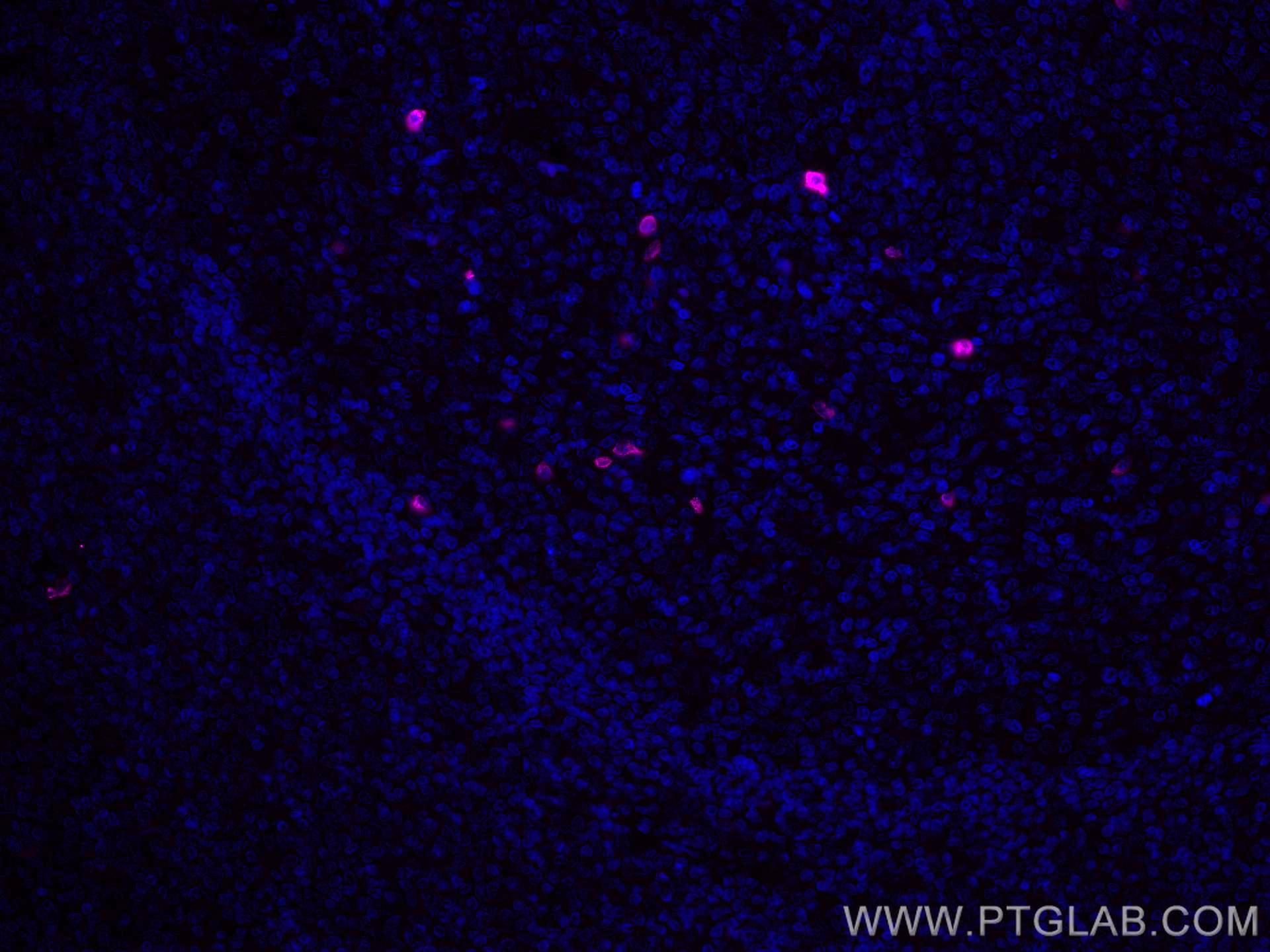 Immunofluorescence (IF) / fluorescent staining of human tonsillitis tissue using CoraLite® Plus 647-conjugated human IgD Monoclonal (CL647-67538)