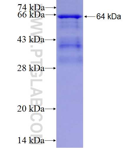 IGHD fusion protein Ag9614 SDS-PAGE