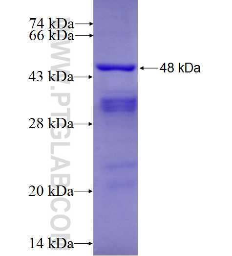 IGHD fusion protein Ag9645 SDS-PAGE
