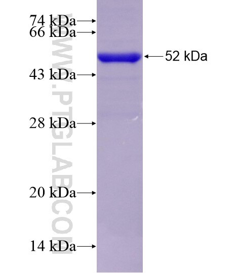 IGHE fusion protein Ag29120 SDS-PAGE