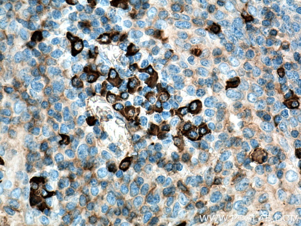 Immunohistochemistry (IHC) staining of human tonsillitis tissue using human IgG heavy chain Polyclonal antibody (16402-1-AP)